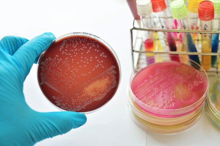 WARNING: These 4 STDs Are Becoming ‘Untreatable’